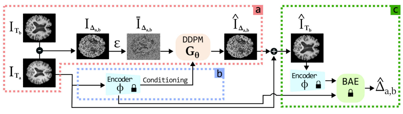 Temporally aware diffusion model on brain MRI progression